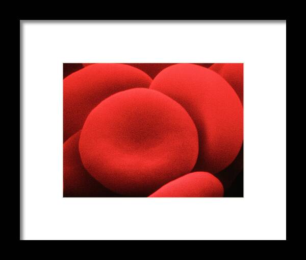 Sem Framed Print featuring the photograph False-colour Sem Of Normal Human Red Blood Cells by Dr. Tony Brain/science Photo Library.