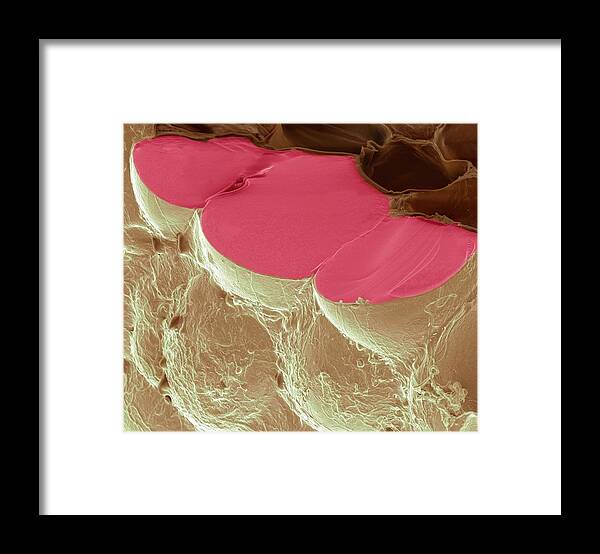 Adipocyte Framed Print featuring the photograph Fat Cells by Steve Gschmeissner/science Photo Library