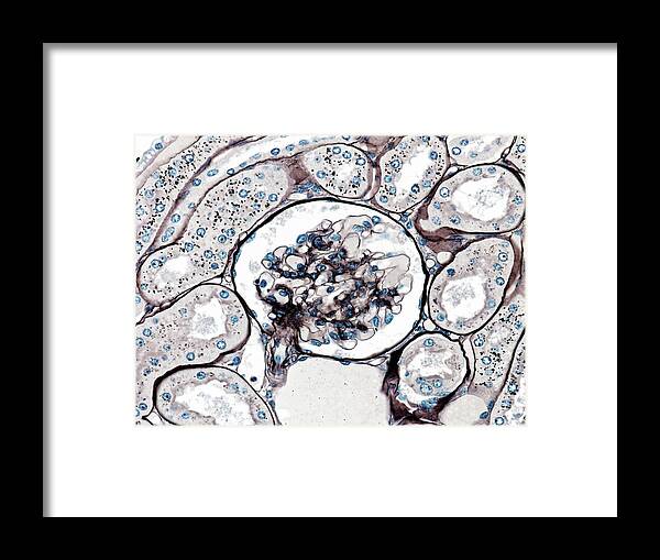 Glomerulus Framed Print featuring the photograph Glomerulus by Microscape