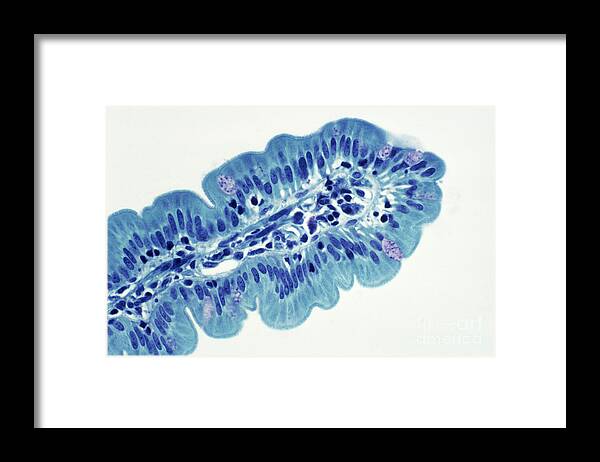 Histology Framed Print featuring the photograph Intestinal Villi Lm by Dr. Cecil H. Fox