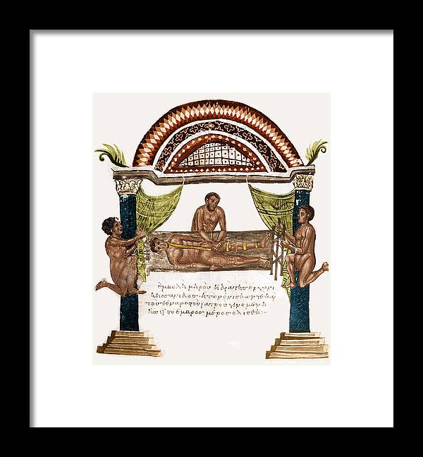 Science Framed Print featuring the photograph Joint Dislocation Treatment, 1st by Science Source