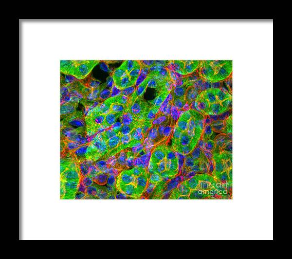 Light Micrograph Framed Print featuring the photograph Light Micrograph Of Kidney Tissue by Lauren Piedmont