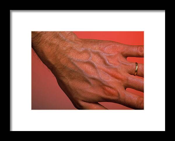 Hand Framed Print featuring the photograph Man's Hand by Pascal Goetgheluck/science Photo Library