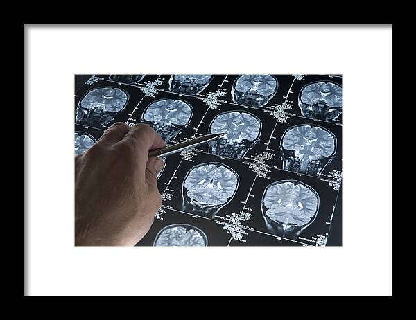 Wired Framed Print featuring the photograph MRI Brain Scan of head and skull with hand pointing by Haydenbird