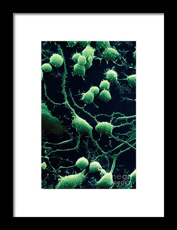 Dendrites Framed Print featuring the photograph Nerve Cells by David M. Phillips