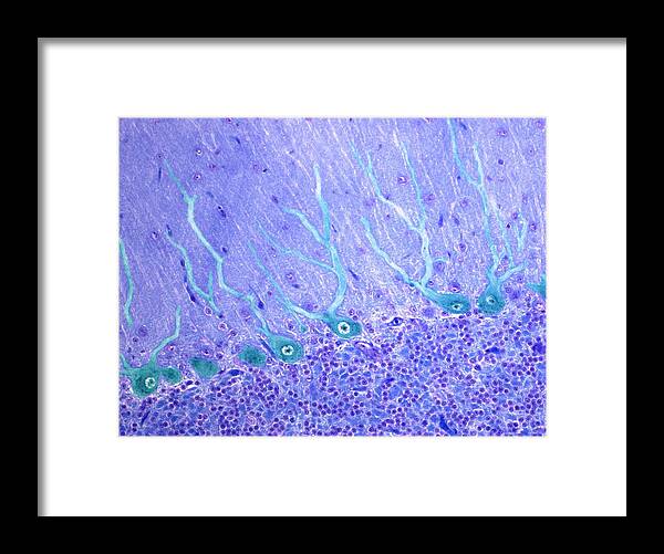 Brain Framed Print featuring the photograph Nerve Cells, Light Micrograph by Science Photo Library - Steve Gschmeissner