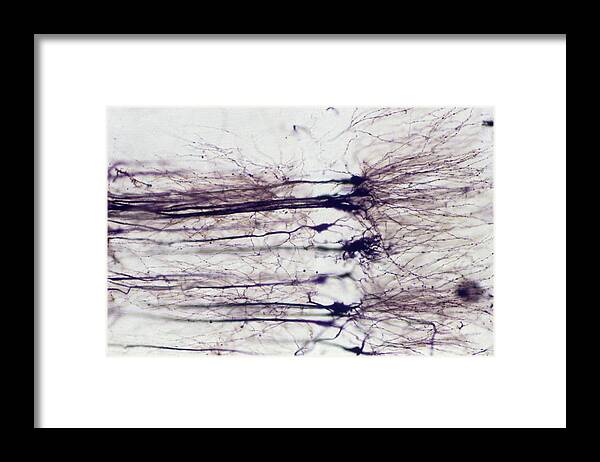 Anatomical Framed Print featuring the photograph Nerve Cells by Overseas/collection Cnri/spl