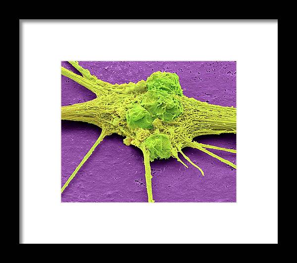 Culture Framed Print featuring the photograph Neurone by Steve Gschmeissner/science Photo Library