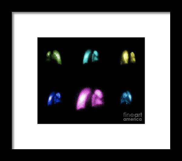 Nuclear Lung Scan Framed Print featuring the photograph Nuclear Medicine Lung Scan by Living Art Enterprises, LLC