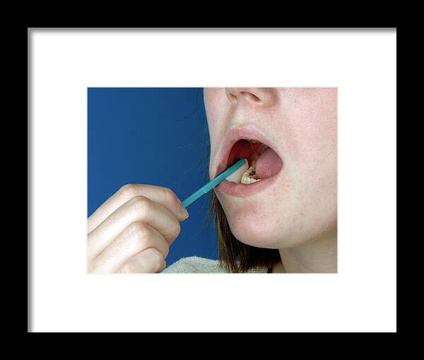 Human Framed Print featuring the photograph Oral Specimen Collection Device by Public Health England/science Photo Library