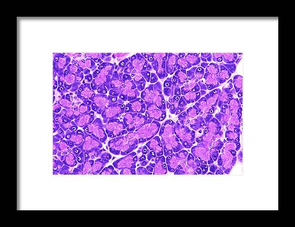 Acinar Cell Framed Print featuring the photograph Pancreas by Microscape