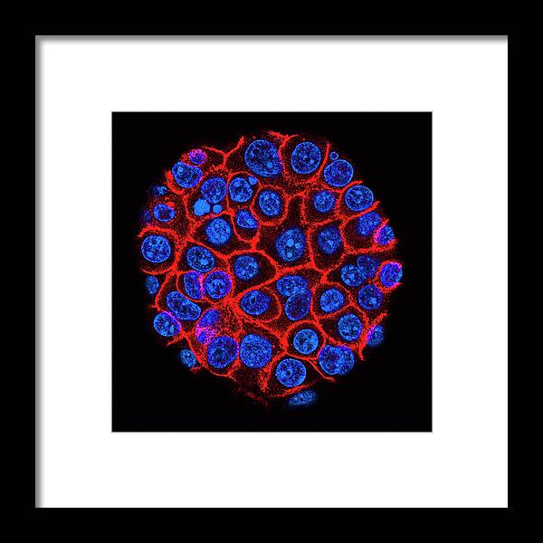 Cell Framed Print featuring the photograph Pancreatic Cancer Cells by Usc Norris Comprehensive Cancer Center/national Cancer Institute/science Photo Library