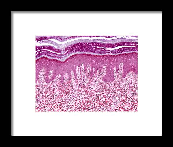 Skin Framed Print featuring the photograph Plantar Skin, Lm by Alvin Telser