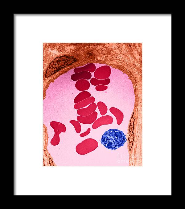 Microscopy Framed Print featuring the photograph Rbcs And Granulocyte, Tem by David M. Phillips