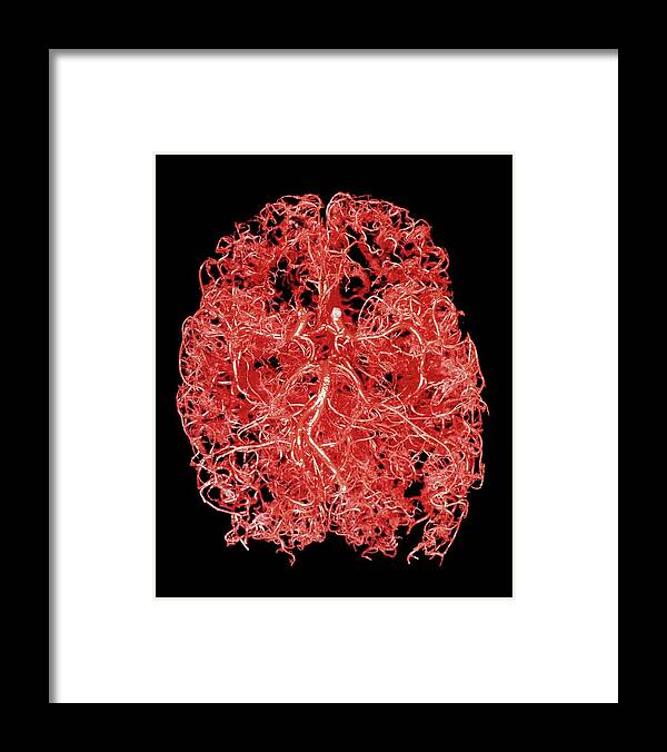 Human Body Framed Print featuring the photograph Resin Cast Of Blood Supply To The Brain by Science Photo Library