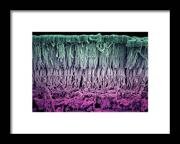 Retina Framed Print featuring the photograph Retina Layers by Louise Hughes/science Photo Library
