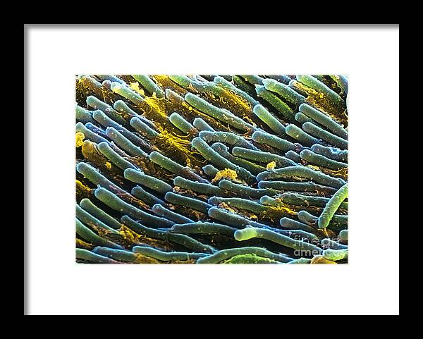 Anatomy Framed Print featuring the photograph Rod Cells by Spl