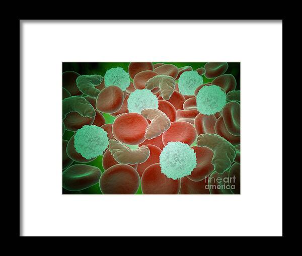 Abundance Framed Print featuring the digital art Sickle Cell Anemia With Red Blood Cells by Stocktrek Images