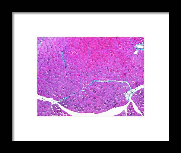 Tissue Framed Print featuring the photograph Skeletal Muscle Tissue by Microscape