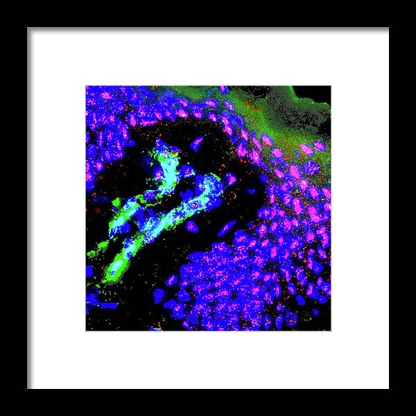 Biology Framed Print featuring the photograph Skin by R. Bick, B. Poindexter, Ut Medical School