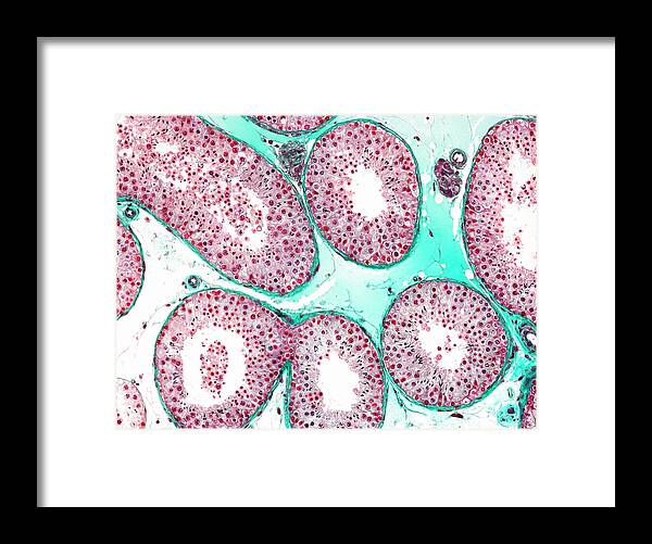 Testis Framed Print featuring the photograph Testis by Microscape