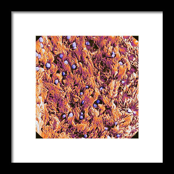 Human Framed Print featuring the photograph Trachea, Showing Cilia And Goblet by Biophoto Associates