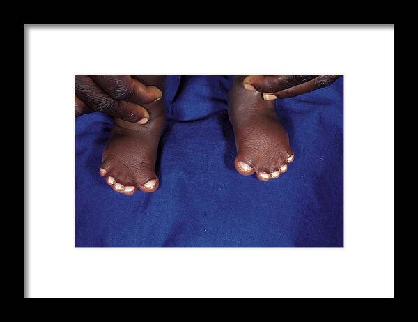 Feet Framed Print featuring the photograph Webbed Feet by Dr M.a. Ansary/science Photo Library