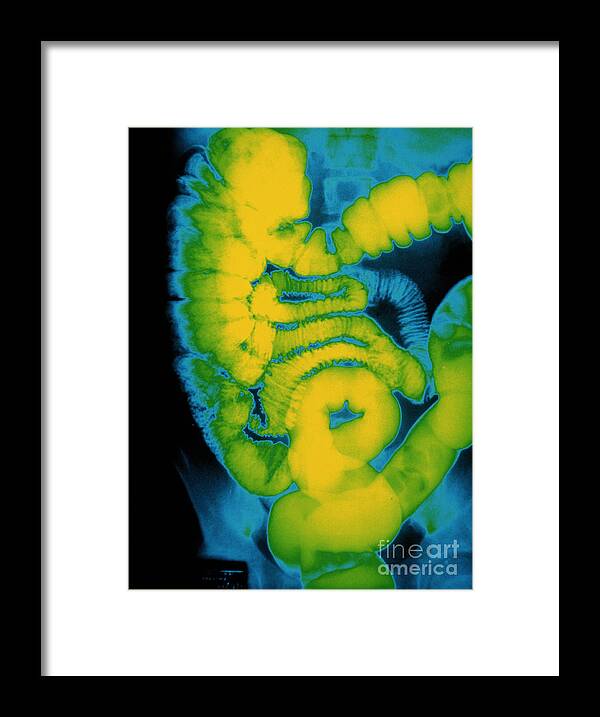 Barium X-ray Framed Print featuring the photograph X-ray Of Large Intestine by Susan Leavines