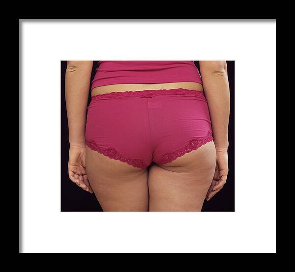 Voluptuous Framed Print featuring the photograph Young woman in underwear, close-up, rear view by John Slater