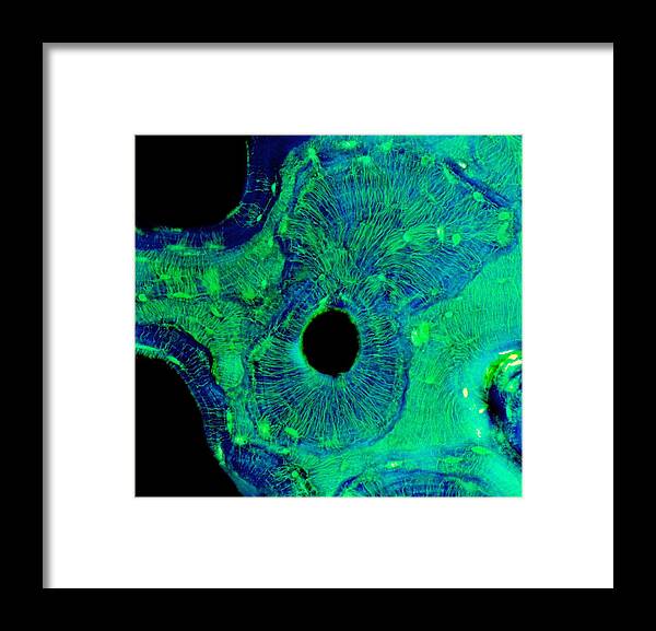 Square Framed Print featuring the digital art Compact Bone, Light Micrograph #1 by Steve Gschmeissner