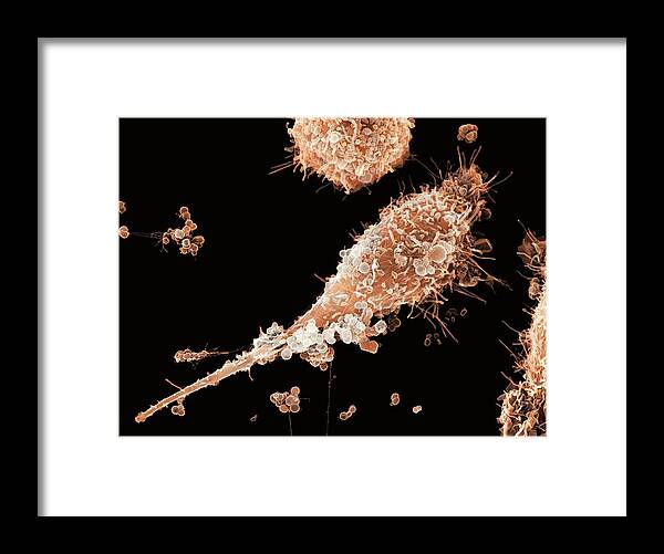 Neisseria Gonorrhoeae Framed Print featuring the photograph Epithelial Gonorrhoea Infection, Sem #1 by 