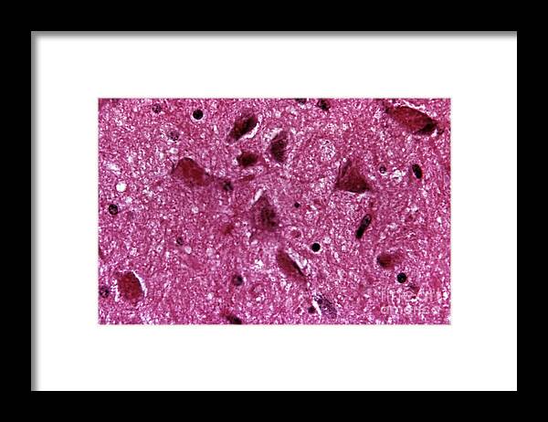 Science Framed Print featuring the photograph Rabies Virus, Lm #1 by Science Source
