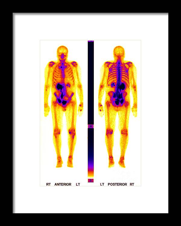 Biology Framed Print featuring the photograph Nuclear Medicine #2 by Ted Kinsman