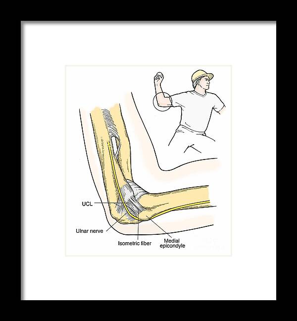 Anatomy Framed Print featuring the photograph Illustration Of Elbow Ligaments #3 by Science Source
