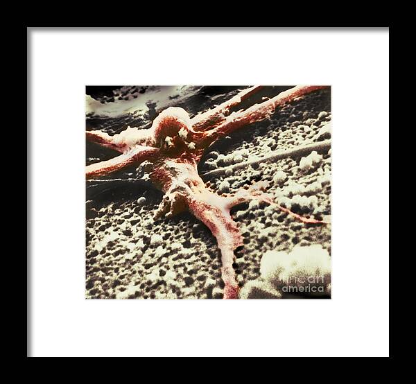 Cancer Framed Print featuring the photograph Malignant Cancer Cell #3 by Omikron