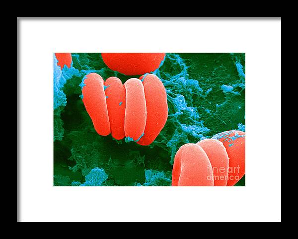 Biology Framed Print featuring the photograph Red Blood Cells, Rouleaux Formation, Sem #3 by Science Source