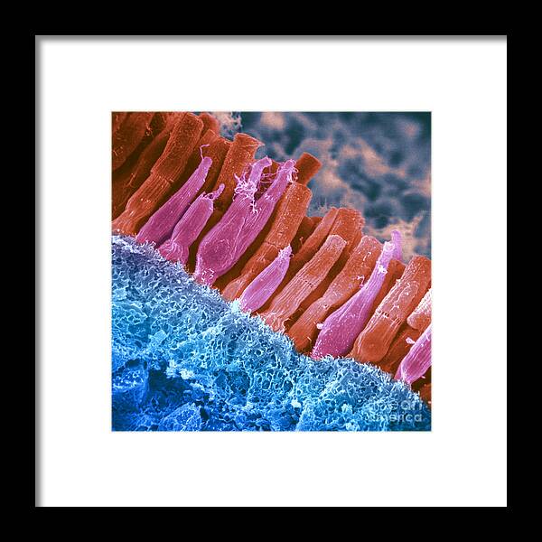 Scanning Electron Micrograph Framed Print featuring the photograph Rods And Cones In Retina by Omikron