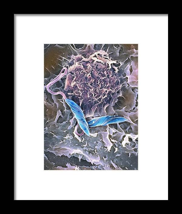 Leishmania Mexicana Framed Print featuring the photograph Macrophage Attacking A Foreign Body, Sem #6 by 