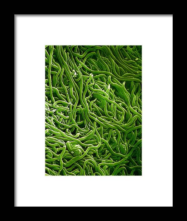 Borrelia Framed Print featuring the photograph Borrelia Bacteria, Sem by Biomedical Imaging Unit, Southampton General Hospital