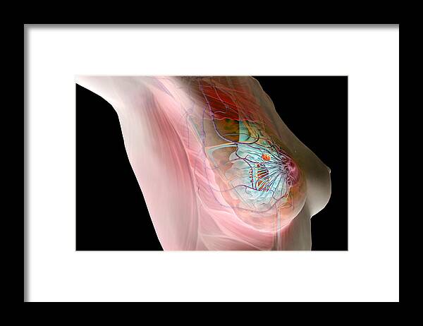 Horizontal Framed Print featuring the digital art Breast Cancer by MedicalRF.com