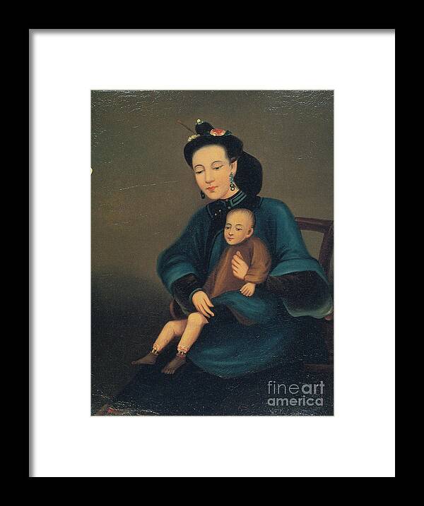 History Framed Print featuring the photograph Child With Gangrene by Science Source