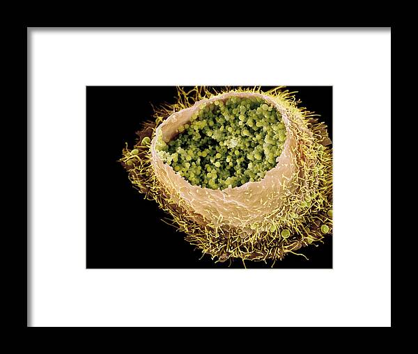 Chlamydia Trachomatis Framed Print featuring the photograph Chlamydia Infection, Sem by 