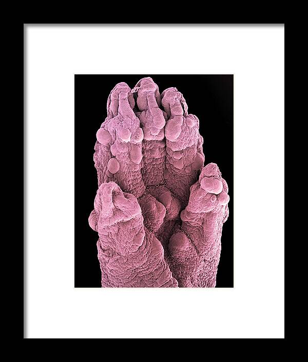 Mouse Framed Print featuring the photograph Foetal Mouse Foot, Sem by Steve Gschmeissner