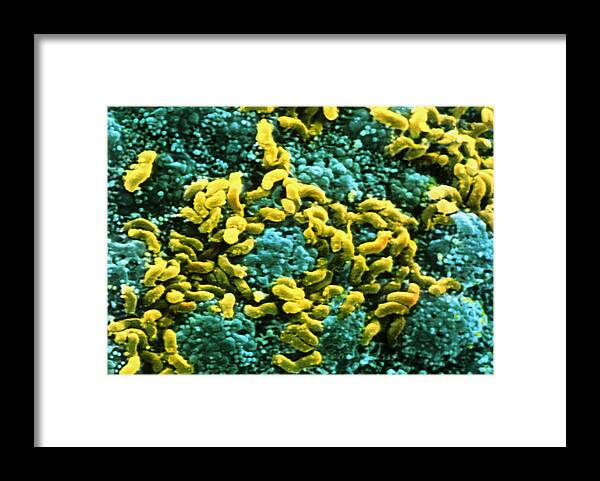 Helicobacter Pylori Framed Print featuring the photograph Helicobacter Pylori Bacteria On Stomach by Prof. P. Mottadept. Of Anatomyuniversity \la Sapienza\, Rome