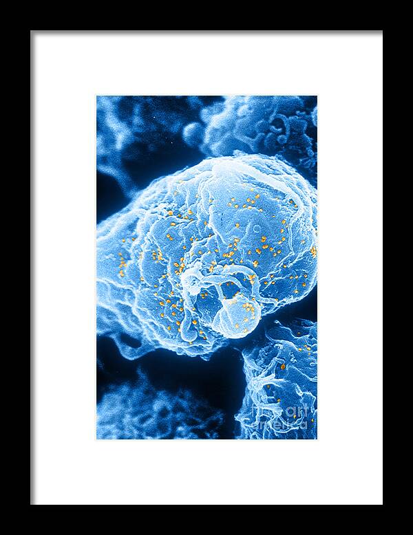 Medical Framed Print featuring the photograph Hiv-1 Infected T4 Lymphocyte Sem by Science Source