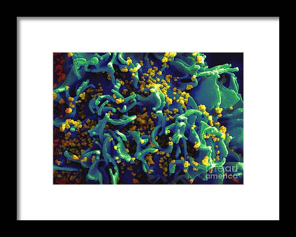 Microbiology Framed Print featuring the photograph Hiv-infected H9 T Cell, Sem by Science Source