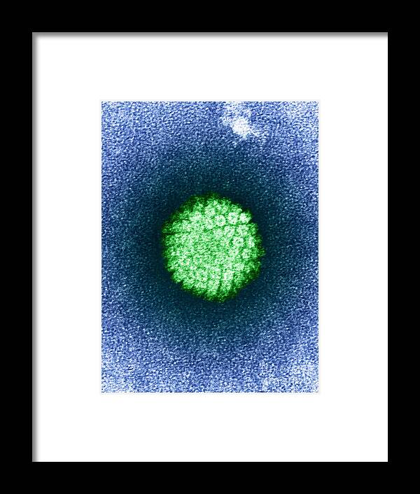 Tem Framed Print featuring the photograph Human Papilloma Virus Hpv by Science Source