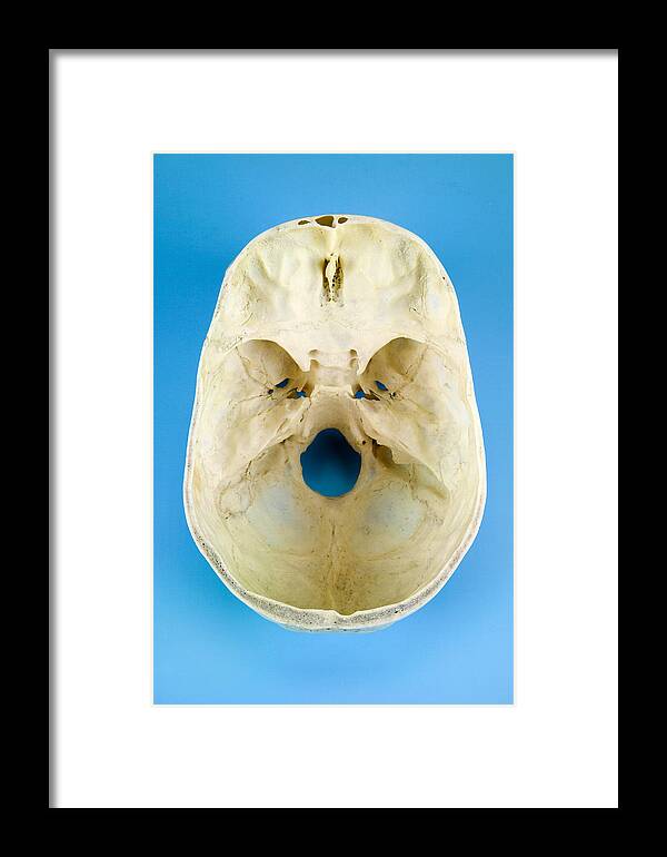 Interior Of A Human Skull Top View Framed Print