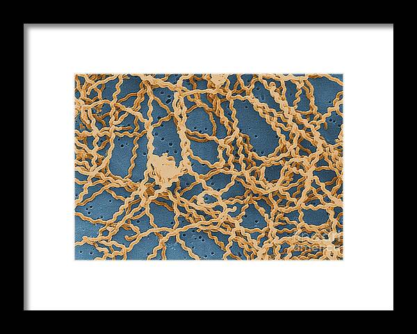 Spirochete Framed Print featuring the photograph Leptospira by Science Source