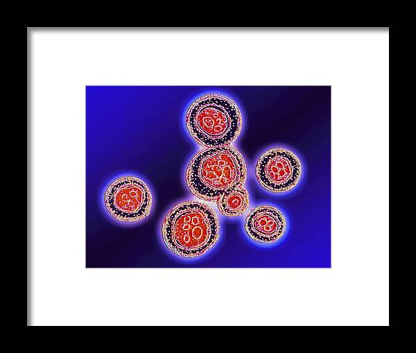 Cryptococcus Neoformans Framed Print featuring the photograph Lm Of Cryptococcus Neoformans Fungi by Pasieka